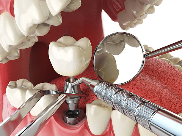 Best Emergency Dental Care for Broken or Chipped Teeth in Forest Hills, PA